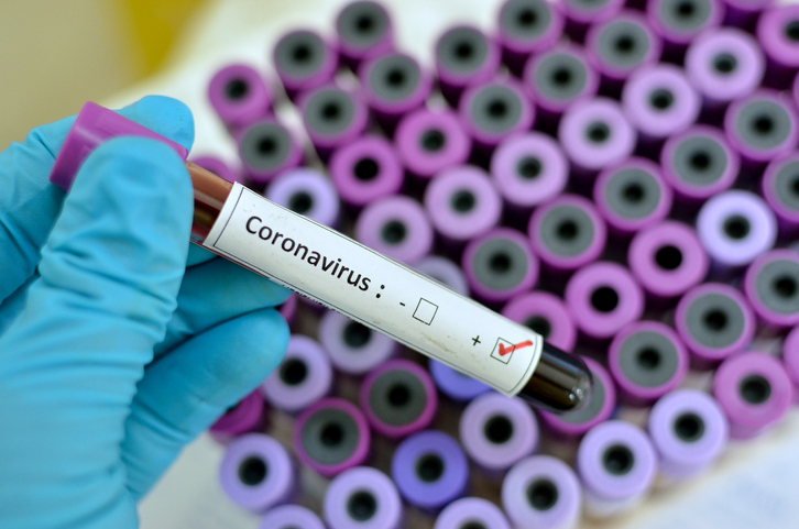 Resultat d'imatges per a "coronavirus"